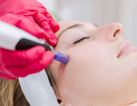 From PRF to Micro-Needling: Modern Beauty Techniques to Try