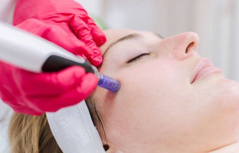 From PRF to Micro-Needling: Modern Beauty Techniques to Try