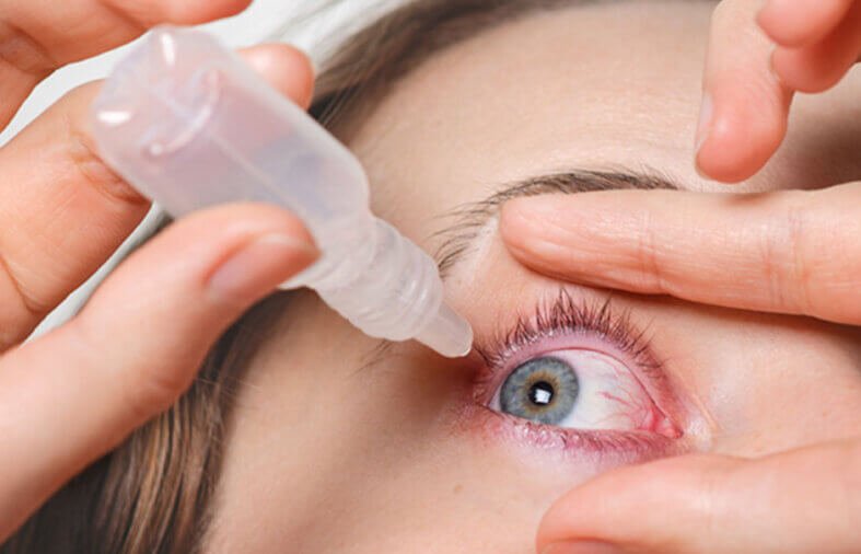 Understanding Common Eye Conditions: Symptoms and Treatments